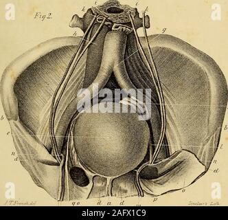 . L'anatomie et de chirurgie de hernie abdominale. J.^rLck^J Fr., del Siru2az7-s Xiuh- DANS LA PLAQUE VIIL-Fig. 1. Sur le côté droit est vu un sac herniaire inguinale oblique sur l'ante-vant partie de le cordon spermatique. Sur le côté extérieur de ce appearsan hernie anus artificiel, formé à partir d'une deuxième saillie de l'intestin sur l'ancien de chaque côtédu : à l'ouverture de l'iléum avait une procidence du, mais à faire thepreparation c'était retourné dans l'abdomen. Ces deux hernie ? Hadpassed grâce à l'anneau de l'abdomen, et étaient situés sur le côté extérieur de l'artère épigastrique, qui a une courbe inhabituelle Banque D'Images