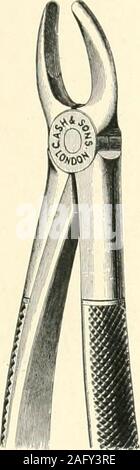 . La science et la pratique de la chirurgie dentaire. Fig. 889. - ForUpper Forceps incisives, Canines, prémolaires et la première. {Mm. Claudius Ash,fils, d- Co., couvercle.) - Pré- forUpper Forceps FiG. 890, deuxième molaires.(MM. Claudius Ash & Sons Co., Ltd.) mouvement vers l'extérieur de l'extrémité distale de la tige ou le levier se déplace légèrement outwardsthe fine paroi extérieure du support osseux à itsfree marge, élargissant ainsi l'ouverture. ofemergence En même temps le point du cône se déplace en bas et en dedans,et si sa voie serait sans entrave se trouvent le long acurve. Mais il empiète sur le rendement de l'ONU dense inne Banque D'Images