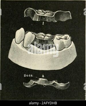 . La science et la pratique de la chirurgie dentaire. 853.-Le Cas 3. Fig. 854.-Le Cas 4. 635. Banque D'Images