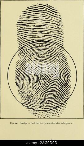 . Guide pour l'identification d'empreintes digitales [ressource électronique]. visible à préparer deux photographsfor différemment telle encerclé l'élargissement, ou trois si trois points probables indiquent practicalpossibilities dans un cas important, et ainsi de suite. Le cercle peuvent bedrawn après l'élargissement si le centre et le rayon ont été markedbeforehand dans l'original. Cela donne une meilleure apparence. Un circleenlarged par la photographie n'est pas très et maladroit. L'intérieur edgeshould uniformément suivie dans un tel cas. Voir fig. 17 et 24. 7. Les agrandissements photographiques devraient de préférence être influencée papier sans glaçure. Il Banque D'Images
