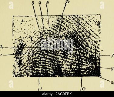 . Guide pour l'identification d'empreintes digitales [ressource électronique]. ommentaires bien au-delà de ce qui est susceptible d'être practicallyrequired ou à être spécialement convaincant en preuve de enlargedfinger-prints. L'échelle des diamètres 20 ou 30 probablybe serait plus acceptable sur le continent, et l'uniformité de l'identification internationale de fins criminels importants certainlybe souhaitable, pas plus que les frais d'une conférence soit gaspillé. Theobjection qu'un jury ait aux mesures de lignes, etc.,étant exprimés en termes métriques ne s'appliquent pas nécessairement à la lorie Banque D'Images