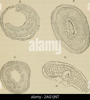 . La pathologie et le traitement des maladies des ovaires. avec un pic d'errance d'ovules. Que la plupart des follicules de De Graaf ainsi produit-que, en fait, un très grand nombre de ceux qui sont produits dans la vie adulte, y compris des nombreux qui atteignent presque à maturité-mourir sans rupturingand s'acquitter de leur œuf-noyau, est rendue certaine par theobservations de chaque écrivain sur l'ovaire, et j'ai alreadyindicated Balfours, d'écrits, les possibilités de leur ulti-mate sort. Dans un papier très remarquable par la Dre Creighton, de Cambridge,publié dans le treizième volume du journal d'Anatomyand Physiolog Banque D'Images