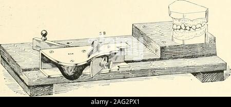 . La science et la pratique de la chirurgie dentaire. Fig. 266.-ST, outil de traçage. T, trépied à régler des tampons en caoutchouc. (G. . {Messrs.Northcroft) Claudius Ash, Sons & Co.) lavés avec un antiseptique. La prise d'animpression dans le plâtre n'est pas differfrom grandement la méthode utilisée en médecine dentaire pro.sthetic,et n'a pas besoin d'être décrite en détail. m Theflanges du plateau devrait être assez profonde tocover les gencives sur l'aspect buccal, l'trayshould être juste assez grand pour permettre d'environ. Fig. 267.-SB, f^liooti ng conseil. P, en avion. (G. Northcroft.) (MM. ClaudiusAsh, fils S Co.) J uich de plâtre entre elle un Banque D'Images