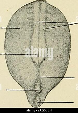 . Pathologie gynécologique ; un manuel de technique microscopique et au diagnostic dans la pratique gynécologique, pour les étudiants et les médecins. dans le processus de développement embryonnaire, que ne l'uro-génitales système. Nous trouvons d'abord la formation de la tête, des reins, orpronephros avec son conduit excréteur, l'de Wolff. Sa place est thentaken par le mésonéphros, ou corps de Wolff, avec le même canal excréteur.Les deux sont remplacés par l'insuffisance rénale permanente, ou le bodybecoming nephros, Wolff le parovarium et le conduit de devenir le canal de Gartner.Nous observons leur étroite relation avec les canaux de Muller (t Banque D'Images