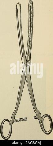 . La chirurgie moderne, général et du dispositif. Fig. 758.-Fowlers Méthode de la gastro-enterostomy. Fig. 759.--Moynihans forgastric humide et opérations intestinales(faites par les Frères, Londres). Artère colique moyenne, récupérer un peu de la surface des mesocolonby une paire de pinces hémostatiques, retirez-la de la partie postérieure de l'stomachwall, et ouvrir le sac du péritoine moindre par les ciseaux. Agrandir l'theopening par la dilatation ou la déchirure jusqu'à ce qu'il admet trois doigts. Inspecter la paroi gastrique postérieure andfeel. Placez l'estomac dans sa position naturelle,marque avec le pouce le plus bas de la partie postérieure de l'er Banque D'Images