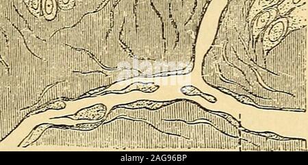 . Un traité pratique sur les maladies de la peau, à l'usage des étudiants et des praticiens. couche de l'épiderme d'encercler dans un spiraldirection à la fois nerveux et vasculaires des papilles. À l'apex des thelatter ces fils entourent totalement les fibres des tissus conjonctifs. Le nom de cette partie de la derma est destiné à décrire les itschief caractéristique, l'existence de nombreux prolongements numériques du corium, composé de fibres délicates des tissus conjonctifs, ce qui ne l'ANATOMIE ET PHYSIOLOGIE DE LA PEAU. 23, de l'entrelacement et qui sont abondamment fournis avec les noyaux. Le papillaespring chaque Banque D'Images