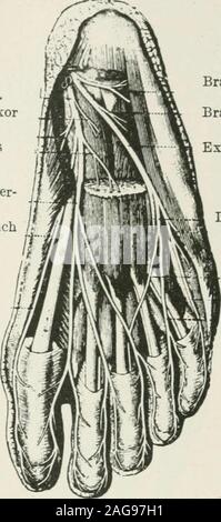 . Médecine et chirurgie. phenonsnerve. La FIA. 64 -Troubles musculo-cutané, andanterior nerfs tibiaux. Fig. 65.-poplité interne andposterior nerfs tibiaux. Le grand nerf sciatique, découle de l'angle supérieur de la veine d'espace.Il passe le long du tendon de theinceps et derrière la tête de thefibula, enroulement autour du cou de cet os, qui est le chosenfor la palpation de ce nerf, puis se termine en divisant dans lavis des insertions de l'orteil péroniers latéraux (fig. 64). 15G FORMES CLINIQUES DE LÉSIONS NERVEUSES Son colloteral les branches sont une branche articulaire pour le genou, nerf de la theaccessory Banque D'Images