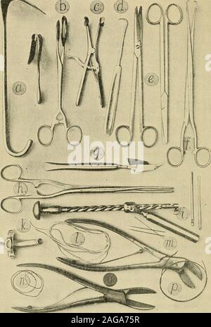 . La chirurgie opératoire. c la cautérisation, ecraseur, ou ligature. La dernière méthode et thegalvanic cautère méthode devrait être exclu, que la plus grande longueur d'timerequired et la grande douleur causée par cette dernière, et plus dangersfrom l'hémorragie et de la septicémie de l'ancienne, inapte pour les utiliser. Si thediseased partie être petit, il peut être enlevé par l'incision calculatedto mieux accomplir l'objet, puisque c'est un mauvais plan pour assurer la symétrie de l'ex-pense de la sécurité future. Si l'hypertrophie apex, ou si une tumeur helocated à cette situation, soit la condition peut être traitée par la suppression de Banque D'Images