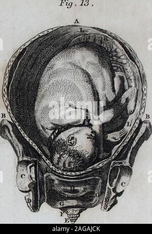 . La pratique de la physique d'Édimbourg, la chirurgie, et les sages-femmes : précédé d'un résumé de la théorie de la médecine et la nosologie du Dr Cullen et dont plus de six cents formules authentiques des livres de Saint George's, Bartholmews Saint Thomas, Guy's, et d'autres hôpitaux de Londres, et de la conférences et écrits des plus éminents enseignants public ; avec vingt tôles quarto. Banque D'Images