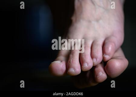 Close up of shamed femme cachant son altlete pied de la maladie. Pieds Smelly weaty porteur d'une maladie infectieuse Banque D'Images