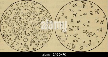 . Le côté drôle de la physique : ou, Les mystères de la médecine, la présentation de l'humour et de sérieux et d'autre de la pratique médicale. Un exposé des humbugs médicaux, des charlatans, et charlatans dans tous les âges et tous les pays. Les EAUX GRASSES DU LAIT (amplifiés). G06 EFFETS DES EAUX GRASSES DU LAIT. Le résultat de l'alimentation des enfants sur ce ofdiet article pernicieux est de générer la scrofule, maladies de la peau, le rachitisme, diarrhée,. Lait pur. Arrosées de lait. Le choléra infantile, et de la consommation, ou de marasme - wastingaway. Banque D'Images