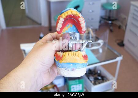 Prothèse amovible dans les mains d'un médecin dans un cabinet dentaire Banque D'Images