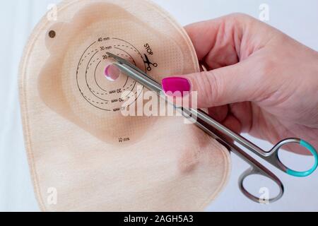 Vue de dessus sur sac de stomie et ciseaux à la main féminine sur fond blanc. Close-up sur la pochette de colostomie de couleur de peau - alimentation nécessaire après colostomie sur Banque D'Images