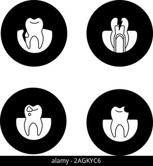 Glyphe de dentisterie icons set. Stomatologie. Saignement des gencives, dents, dent cassée, les caries. Vector silhouettes blanc illustrations de cercles noirs Illustration de Vecteur