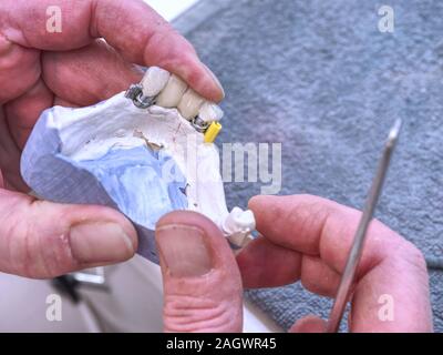 Outils de dentiste sur la table de laboratoire dentaire. Soins dentaires, d'orthodontie technicien travaillant sur de fausses dents. table avec des outils de dentiste. Banque D'Images