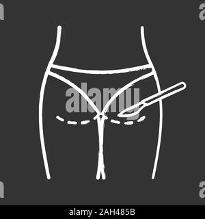 Chalk Gluteoplasty icône. L'augmentation des fesses et la liposuccion. Chirurgie des fesses. La chirurgie plastique. Vector illustration tableau isolé Illustration de Vecteur