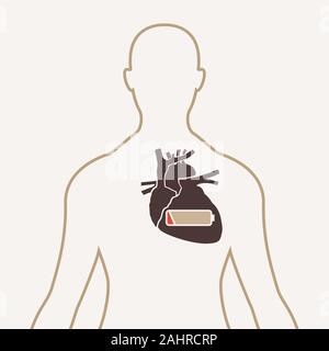 Le syndrome d'épuisement professionnel logo icône vector Illustration de Vecteur