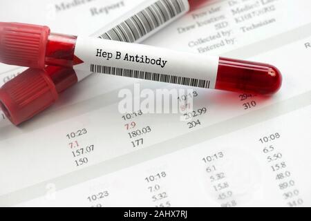 Test sanguin des anticorps de l'hépatite B sur le rapport de laboratoire. Niveau d'anticorps de surface de l'hépatite B peut être mesuré afin de déterminer si la vaccination contre l'hépatite B Banque D'Images