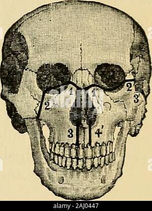 Chirurgie du dispositif de traitement et d'ions .. Lossof sang, est le seul, en plus le choc commun à alloperations, qui nécessite une attention particulière au départ. Depuis l'hémorragie interne des artères maxillaires du visage et, s'ils sont souvent abondantes, peuvent bepromptly contrôlée par la pression. Les lignes d'incision.-Les lignes d'incision peut être faite dans les oudepuis sans la cavité buccale (Fig. 380). Le retrait de l'os fromwithin la cavité buccale, c'est fastidieux, comme l'espace est limité et le opportunityto relativement contrôler l'hémorragie inadéquates. À l'heure actuelle ex-incisions externes o Banque D'Images