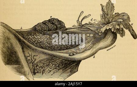 La pathologie et le traitement des maladies des ovaires : (en cours de l'essai pour l'Hastings 1873).. Hue, nacré . ici et là avec ahazy bleu montrant à travers la tunique lorsqu'un follicule iseither étant prêt pour l'exercice de son noyau ou est-pearing disparu après avoir rempli son rôle. Lorsqu'un follicule iseither sur le point d'éclater ou vient d'éclater, le site est d'une couleur brun-purftle. Les glandes sont de forme ovale et aplatie, frombefore vers l'arrière, la surface antérieure étant plus courte et lessconvex que le postérieur, qui est plus arrondi. Le outerextremity est aussi arrondi et l'ampoule-li Banque D'Images