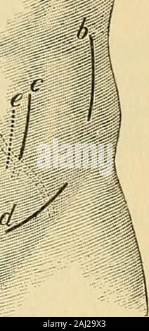 La chirurgie opératoire . iV. Fig. 180.-linéaire guides.a. Pour la ligature de l'aorte (Cooper), i. Forligature (iliaque commune de Crampton). c. Pour de ligature iliaque commune (McKee). d. Pour la ligature de andcircumflex arteiies épigastrique profonde iliaque. e, e, e. En Inci-sions, supérieur, inférieur et lateralregions. /. Inmedian incision courbée de la carotide. Fig. 181.-guides linéaires., pour la ligature de iliaque commune (transperi-toneal), h. Pour la ligature de commoniliac (extra péritonéale), ch. Pour ligatureof iliaque commune par le biais de la ligne semi-lunaire(voie transpéritonéale), e. De même throughfibers de rectus, d. Pour d'ex-ligature iliaque externe Banque D'Images