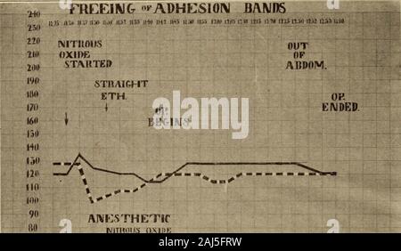 Interstate medical journal . comme les suivantes:La pression systolique et la fréquence cardiaque ont été observées lors de l'thepatient etherizing et atteint la chambre avant l'anesthésie, wasstarted encore une fois au moment où il a été commencé, et au moins une fois tous les cinq iRead avant l'équipe chirurgicale de l'Hôpital général du Massachusetts. INTERSTATE 18 MEDICAL JOURNAL minutes tout au long de l'opération. Dans de nombreux cas, ou wheneverthere avait lieu un changement évident dans les lectures, nous re-corded que changer aussi souvent qu'une fois en deux ou trois minutes. Deplus, il y avait noté l'heure l'opération a commencé, anychange Banque D'Images