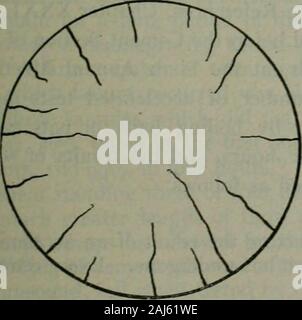 Un traité sur le béton, lisse et renforcée : les matériaux, la construction, et de la conception de béton et béton armé ; 2e éd. . Fig. 36.-Un début de désintégration.*. Banque D'Images