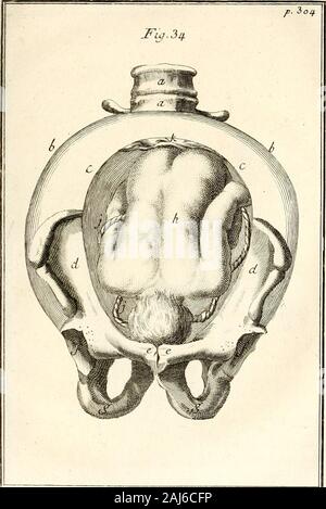 Observations importantes sur le manuel des accouchemens primiere [-seconde] partie : ou l'on trouve tout ce qui est necessaire pour les opérations, . Banque D'Images