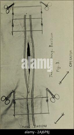 Opérations de la chirurgie gynécologique et du sud de l'Association . Banque D'Images