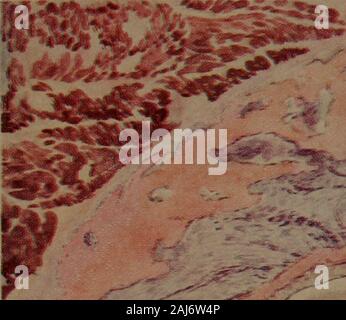 Un texte-livre d'Histologie et Embryologie dentaire, y compris les directions de laboratoire . H t. -, Y.A /•* .vi>m,M "v&K ; 1 I n v|t section longitudinale du Peridental Membrane. Colorés à l'hématoxyline-éosine. Montrant une partie de la frontière de l'gingivusand lingual processus alvéolaire. Assiette XIII.  ? ? ? ? * %D *$*&8i&gt ;**t Section transversale de Peridental Membrane. Colorés à l'hématoxyline-éosine. Fraction alvéolaire. 281 fonctions qui entoure l'apex de la racine et remplit l'apicalspace. Ces sont illustrées dans le diagramme (Fig. 217 et 218). Les éléments structurels.-Ces sont : (1) Blanc con Banque D'Images