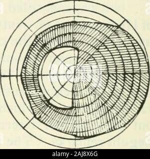 Le Journal of Nervous and Mental Disease . Fig. I, I. Cas-hémianopsie bitemporale. La limite extérieure de l'ombrage representsthe limites du champ normal ; l'ombrage où vision était perdu. la santé de la peau. De bonnes facultés intellectuelles. Pas de l'allure mais,paralyse travaillé, comme celui d'un homme fatigué. Vision de l'œil ineach y2 ; les deux nerfs optiques, gris avec atrophicexcavations peu profondes. Il était typique temporelle bilatérales hemian-opsia concentrique avec limitation du champs préservés.La ligne de division touchait presque le point de fixation, butabove cette tendance à la droite, tandis que ci-dessous il inclinedto la gauche Banque D'Images