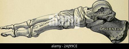 Un traité sur la chirurgie orthopédique . talon, indiqueque le talon est bien adapté pour le roulement de poids, tandis que l'longanterior pilier composé de plusieurs os est moins forte mais plus OETHOPEDIC SUPiGEEY 696 ; ainsi, un élastique s'étend d'instinct le pied dans descendingstairs, par exemple, pour éviter la désagréable pot d'shockreceived direct sur le talon. De ce pilier antérieur, la troisième méta-tarsien plus l'os est le soutien direct, tandis que les plus movablefirst et cinquième métatarsiens, plus sous le contrôle musculaire, l'aide inbalancing le poids et maintenir dans l'attitude différente.La division Banque D'Images