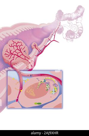 Le cancer colorectal Banque D'Images