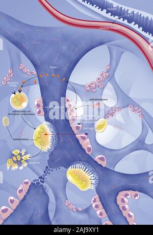 Ostéoporose Banque D'Images
