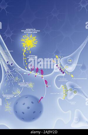 Processus de dégénérescence neurofibrillaire avec neurone, plaque sénile, des traitements. Neurone dans le système nerveux central affectées par clivage anormal de l'APP Banque D'Images