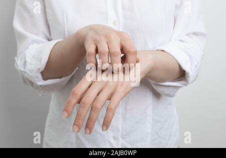 Signes de dermatite et de gale. Femme égratigner les mains. Allergie à la peau. Banque D'Images