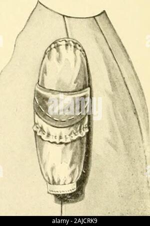 La nouvelle couturière ; avec des instructions complètes et entièrement illustré sur tous les points liés à la couture, de la couture et de la confection, de la suture à l'avant, faisant, la modification, la réparation et le nettoyage des vêtements pour dames, jeunes filles, les enfants, les nourrissons, les hommes et les garçons . 111. 125. Détail de l'MATLRNITY CLOTHLS 79 Manches doublées Banque D'Images