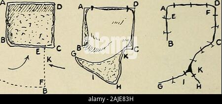 La chirurgie plastique ; ses principes et pratiques . H- H- Fig. 41.-Szymanowskis méthode. r.-. Fig. 42.-Letenneurs méthode. (Szymanowski.) Banque D'Images