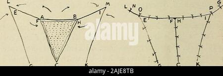 La chirurgie plastique ; ses principes et pratiques . Fig. 10.-Jasches méthode. Fig. ii. Fig. 12. (Szymanowski.) Figues, ii et 12.-Szvmanowskis méthode. G/^. C K C 5 Fig. 13.-Szymanowskis méthode. B A C D " y CJP^ Banque D'Images