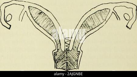 Travaux de la Société médicale de l'État du Connecticut .. . La grossesse DE MALFORMATIONS DE L'UTÉRUS. 173 Banque D'Images