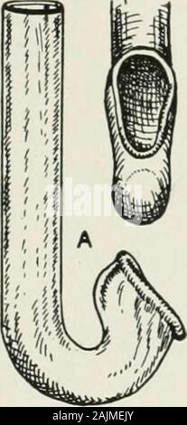 L'American encyclopédie et dictionnaire de l'ophtalmologie édité par Casey d'un bois, assistée par un personnel nombreux de collaborateurs . Des voies aériennes nasopharyngées. Le rapport fait allusion à ils ont insisté sur la grande distinction betweenanesthetics bonne pour une utilisation par le généraliste et anestheticsemployed par des experts. Ils ont enfin recommandé que pour le praticien gé-nérale surtout pas etheradministered ou qualifiés, expérimentés par l'open, ou drop, méthode devrait être l'anesthésie anesthésie dans la chirurgie ophtalmique 425 de choix, et que l'utilisation de chloroforme, en particulier pour l'opération soi-calledminor Banque D'Images