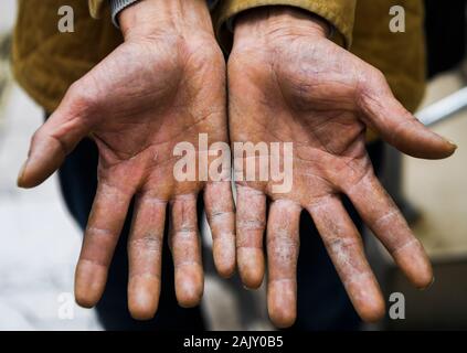 (200106) -- CHONGQING, le 6 janvier 2020 (Xinhua) -- Ran Guanghui montre ses mains rugueuses dans le sud-ouest de la municipalité de Chongqing en Chine, le 5 janvier 2020. Ran Guanghui, 50 ans, a gagné sa vie comme un "bang bang", littéralement "rester les hommes", à Chongqing pendant dix ans. Dans une ville de montagne comme Chongqing, avec une abondance de routes vallonnées et de sentiers, stick men ont aidé les personnes par transport des bagages et objets lourds. Transporter des marchandises sur les poteaux de bambou en équilibre sur leurs épaules, le bâton du pain gagné les hommes à la sueur de leur front. Ran est devenu l'un d'entre eux en 2009 lorsqu'il a quitté sa ville natale Dianjiang, une villa Banque D'Images