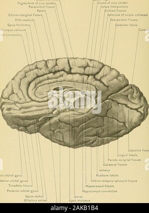 Anatomie chirurgicale : un traité sur l'anatomie humaine dans son application à la pratique de la médecine et chirurgie . est subdivisé en twoconvolutions, la supra-marginal et l'angulaire. La supra-convolution marginal comprend la partie antérieure de l'inferiorparietal aussi loin que l'extrémité postérieure de la branche horizontale de la fissure ofSylvius. Elle serpente autour de cette branche et devient continue avec le sujDcriortemporal et convolution la convolution angulaire. La convolution angulaire est la partie postérieure du lobule pariétal convo- tion ; il se trouve derrière la partie terminale de l'horizo Banque D'Images