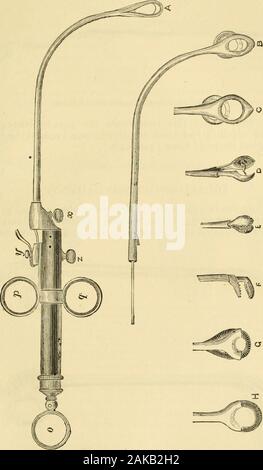 Un manuel des maladies de la gorge et du nez : y compris le pharynx, le larynx, la trachée, l'œsophage, du nez et du pharynx naso-. Forceps. provoquée en touchant une diapositive dans la poignée de l'instrument avec le pouce. Ces pinces sont uniquement adaptés pour la dépose très smallgrowths, mais ils sont particulièrement pratiques pour effectuer evulsion enle commissure antérieure des cordes vocales. lScraseurs de construction différents ont été utilisés pour le removalof excroissances laryngé avec plus ou moins de succès depuis l'invention du laryngoscope. Dans ce pays, les Drs. Walker, Gibb, et GeorgeJohnson ont employé Banque D'Images