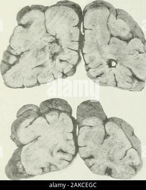 Mémoires . 4l JP XVI-k-1 CAS XVI - MACROGYRIAMemoirs American Academy of Arts and Sciences. Tome XIV.-Recherches de Waverley. XVI-m-n Banque D'Images