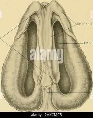 Anatomie chirurgicale : un traité sur l'anatomie humaine dans son application à la pratique de la médecine et de la chirurgie. Sésamoïdes cartilages cartilage latéral inférieur du tissu fibreux de l'ala de cartilages latéraux nez NEZ DE PLAQUE 287.CCXIX. Septum de cartilage du nez. ateral tissu fibreux cartilage d'ala de l'nez spineof nasale antérieure maxillaire supérieure DES CARTILAGES À LA BASE DU NEZ,PLAQUE 290 CCXX. Plaque verticale de l'ethmoïde sinus Sphénoïdal Banque D'Images