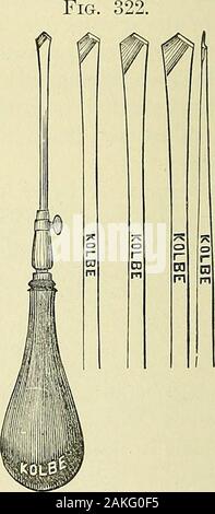 Un manuel de la chirurgie moderne : une exposition des doctrines et des procédures approuvées de l'heure actuelle, à l'usage des étudiants et des praticiens . La résection de l'articulation du genou. (Kocher. ) Bone drill pour utilisation dans suturingbones après excision. L'excision de l'articulation de la cheville. Cette opération est effectuée de façon satisfaisante par une incision semi-lunaire sur l'extérieur de l'articulation, s'étendant de la face antérieure de l'thejoint autour sous la malléole externe et vers le haut le long du bord externe de l'ex-le tendon d'Achille. Le long et court-peroneimuscles peut exiger ; division mais dans certains cas Banque D'Images