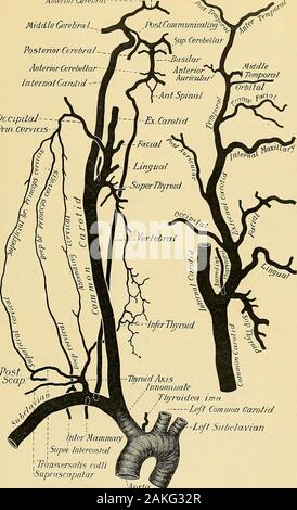 Anatomie chirurgicale : un traité sur l'anatomie humaine dans son application à la pratique de la médecine et de la chirurgie. l'ordre croissant, et un terminal. Le anteriorset est composé de la supérieure, de la thyroïde, multilingue et du visage ; la partie postérieure, l'auriculaire postérieure occipitale,et les ascendants ;, l'ordre croissant ; et theterminal pharyngée, la Temporale superficielle et maxillaire interne. L'artère thyroïdienne supérieure, la première branche compte tenu de l'externalcarotid, surgit juste en dessous du plus grand cornu de l'os hyoïde. Tout au long thegreater partie de son cours elle occupe le triangle carotide supérieure. Il passesforw Banque D'Images