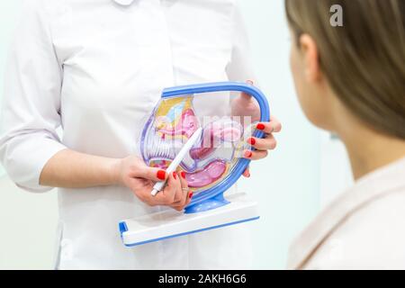 Médecin gynécologue consulting un patient à l'aide de modèle de l'anatomie de l'utérus Banque D'Images