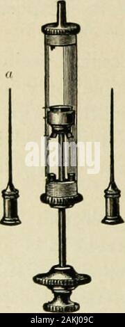 Un manuel de la théorie moderne de la technique et de l'asepsie chirurgicale . ocesses, il est particulièrement indiquésdans tous les cas douteux. En poudre ou en iodoforme solution est indicatedalso la laparotomie après chaque fois qu'il est limite d'desirableto les rejets ; en outre, il appearsthat l'absorption de produits de l'microbesbecomes moins virulent dans ses résultats par les co-absorption de l'iodoforme. Les seringues hypodermiques ordinaires peuvent être sterilizedonly avec beaucoup de difficulté, l'inaccessibilité de la preuve d'un piston a décidé obstacle. RobertKoch se défausse donc le piston en tout, 266. d'asepsie chirurgicale substi Banque D'Images